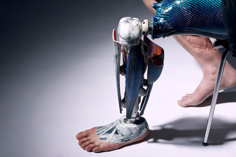 Illustration for article titled Brilliant and bejeweled prostheses designed to stand out instead of blend in